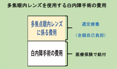 多焦眼内レンズを使用する白内障手術の費用