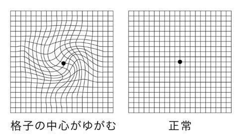 図1