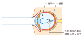 イラスト3